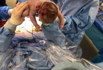 Emily Dial delivers her own child. Photo provided by Emily Dial.